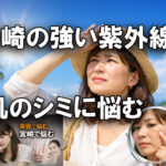 宮崎の強い紫外線で肌のシミに悩むーアイキャッチ画像